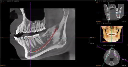 Artificial Intelligence in Dental Imaging – A New Era of Precision and Efficiency