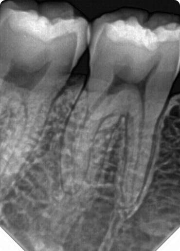 Molar