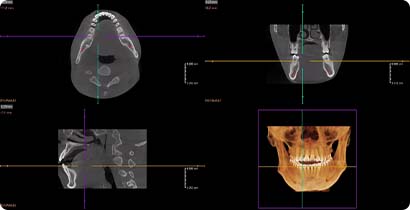 3D CT Images