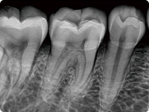 X-Ray Image