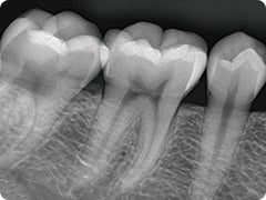 X-Ray Image
