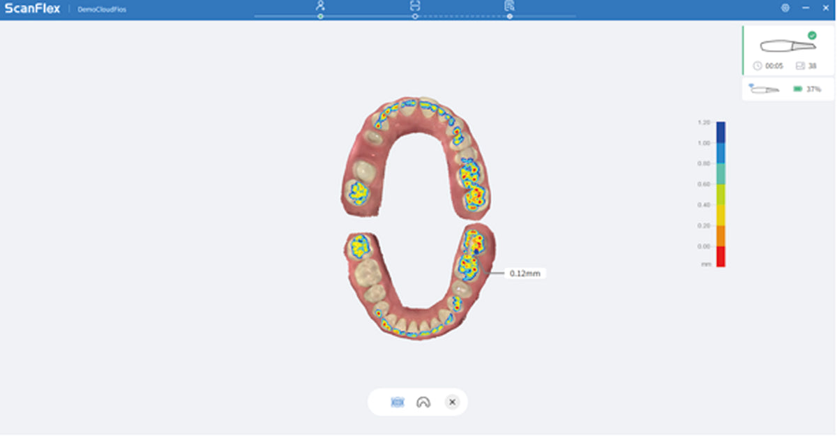 Occlusion Analysis