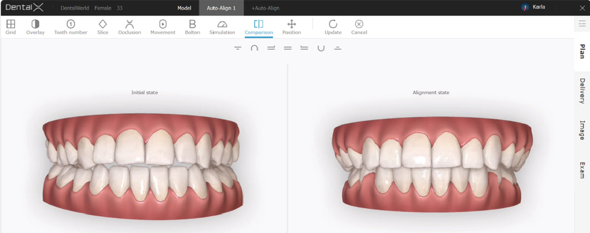 Orthodontic Simulator